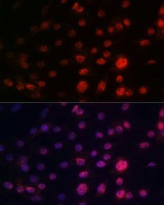 Immunocytochemistry/Immunofluorescence: CRM1 Antibody (1J0L10) [NBP3-15823] - Immunofluorescence analysis of C6 cells using CRM1 antibody (NBP3-15823). Blue: DAPI for nuclear staining.