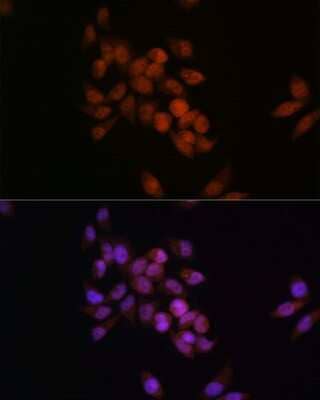 Immunocytochemistry/Immunofluorescence: CRM1 Antibody (1J0L10) [NBP3-15823] - Immunofluorescence analysis of HeLa cells using CRM1 antibody (NBP3-15823). Blue: DAPI for nuclear staining.