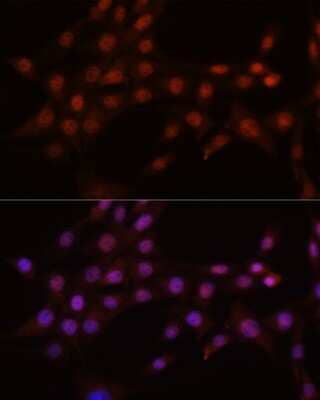 Immunocytochemistry/Immunofluorescence: CRM1 Antibody (1J0L10) [NBP3-15823] - Immunofluorescence analysis of NIH-3T3 cells using CRM1 antibody (NBP3-15823). Blue: DAPI for nuclear staining.