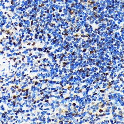 Immunohistochemistry-Paraffin: CRM1 Antibody (1J0L10) [NBP3-15823] - Immunohistochemistry of paraffin-embedded rat spleen using CRM1 antibody (NBP3-15823) at dilution of 1:100 (40x lens).Perform microwave antigen retrieval with 10 mM PBS buffer pH 7.2 before commencing with IHC staining protocol.