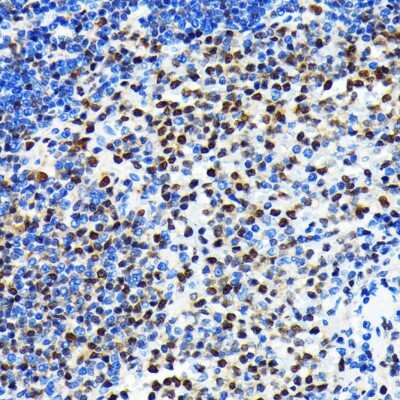 Immunohistochemistry-Paraffin: CRM1 Antibody (1J0L10) [NBP3-15823] - Immunohistochemistry of paraffin-embedded mouse spleen using CRM1 antibody (NBP3-15823) at dilution of 1:100 (40x lens).Perform microwave antigen retrieval with 10 mM PBS buffer pH 7.2 before commencing with IHC staining protocol.