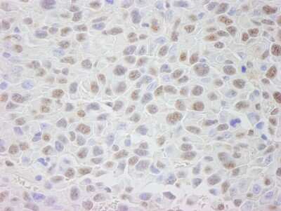 Immunohistochemistry: CRM1 Antibody [NB100-40862] - Sample: FFPE section of mouse squamous cell carcinoma. Antibody: Affinity purified rabbit anti-CRM1 used at a dilution of 1:250. Detection: DAB staining using Immunohistochemistry Accessory Kit