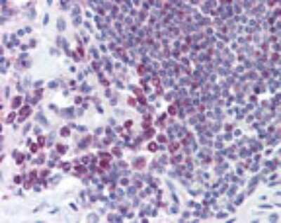 Immunohistochemistry-Paraffin: CRM1 Antibody [NB100-56493] - Analysis of human spleen using this antibody at 10 ug/ml.