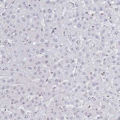 Immunohistochemistry-Paraffin: CRM1 Antibody [NBP2-33381] - Staining of human liver shows no nuclear positivity in hepatocytes.