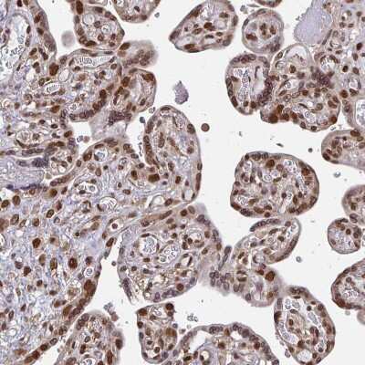 Immunohistochemistry-Paraffin: CRM1 Antibody [NBP2-33381] - Staining of human placenta shows strong nuclear positivity in trophoblastic cells.