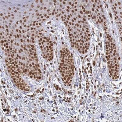 Immunohistochemistry-Paraffin: CRM1 Antibody [NBP2-33381] - Staining of human skin shows strong nuclear positivity in squamous epithelial cells.