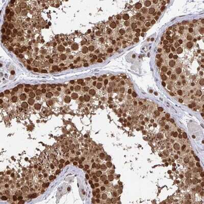 Immunohistochemistry-Paraffin: CRM1 Antibody [NBP2-33381] - Staining of human testis shows strong nuclear positivity in cells in seminiferous ducts.