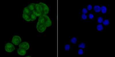 Immunocytochemistry/Immunofluorescence: CRM1 Antibody (JB35-22) [NBP2-75448] - Staining CRM1 in LOVO cells (green). The nuclear counter stain is DAPI (blue). Cells were fixed in paraformaldehyde, permeabilised with 0.25% Triton X100/PBS.