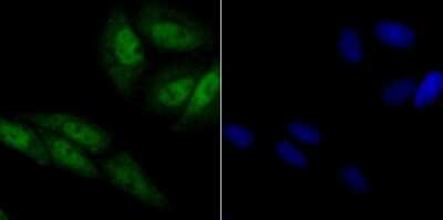 Immunocytochemistry/Immunofluorescence: CRM1 Antibody (JB35-22) [NBP2-75448] - Staining CRM1 in SiHa cells (green). The nuclear counter stain is DAPI (blue). Cells were fixed in paraformaldehyde, permeabilised with 0.25% Triton X100/PBS.