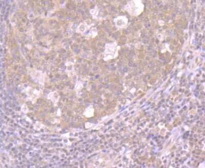 Immunohistochemistry-Paraffin: CRM1 Antibody (JB35-22) [NBP2-75448] - Analysis of paraffin-embedded human tonsil tissue using anti-CRM1 antibody. Counter stained with hematoxylin.