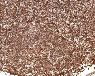 Immunohistochemistry-Paraffin: CRM1 Antibody (JB35-22) [NBP2-75448] - Analysis of paraffin-embedded human lymph node tissue with Rabbit anti-CRM1 antibody washed with ddH2O and PBS, and then probed with the primary antibody  at 1/100 dilution for 1 hour at room temperature. The detection was performed using an HRP conjugated compact polymer system. DAB was used as the chromogen. Tissues were counterstained with hematoxylin and mounted with DPX.