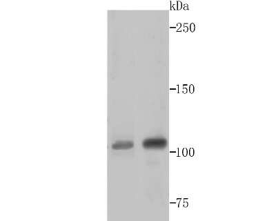 Western Blot: CRM1 Antibody (JB35-22) [NBP2-75448] - Analysis of CRM1 on 293T and Hela cell lysates using anti-CRM1 antibody at 1/500 dilution.