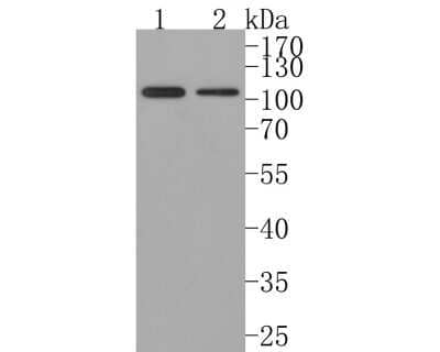 Western Blot: CRM1 Antibody (JB35-22) [NBP2-75448] - Analysis of CRM1 on different lysates. Proteins were transferred to a PVDF membrane and blocked with 5% NFDM/TBST in PBS for 1 hour at room temperature. The primary antibody (1/500) was used in 5% NFDM/TBST at room temperature for 2 hours. Goat Anti-Rabbit IgG - HRP Secondary Antibody at 1:200,000 dilution was used for 1 hour at room temperature. Positive control: Lane 1: Hela cell lysate Lane 2: 293T cell lysate Predicted band size: 123 kDa Observed band size: 110 kDa