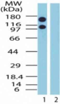 Western Blot: CRM1 Antibody [NB100-56493] - Analysis of Exportin-1 in Jurkat cell lysate in the 1) absence and 2) presence of immunizing peptide using this antibody at 1.5 ug/ml.