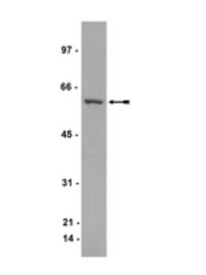 Western Blot: CRMP1 Antibody (Y21) [NBP2-29855] - CL-1 cell lysate was probed with anti-CRMP1 (1:2000 dilution).