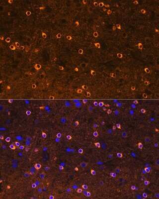 Immunohistochemistry: CRMP2 Antibody (0A1T1) [NBP3-16406] - Immunofluorescence analysis of rat brain using CRMP2 Rabbit mAb (NBP3-16406) at dilution of 1:100 (40x lens). Blue: DAPI for nuclear staining.