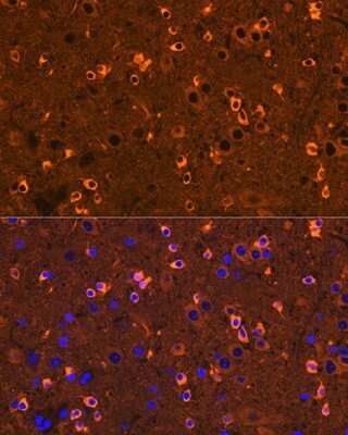 Immunohistochemistry: CRMP2 Antibody (0A1T1) [NBP3-16406] - Immunofluorescence analysis of mouse brain using CRMP2 Rabbit mAb (NBP3-16406) at dilution of 1:100 (40x lens). Blue: DAPI for nuclear staining.