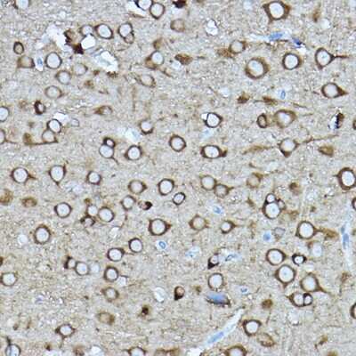 <b>Genetic Strategies Validation. </b>Immunohistochemistry-Paraffin: CRMP2 Antibody [NBP2-92939] - Immunohistochemistry of paraffin-embedded rat brain using [KO Validated] CRMP2/CRMP2 Rabbit pAb (NBP2-92939) at dilution of 1:400 (40x lens). Perform high pressure antigen retrieval with 10 mM citrate buffer pH 6.0 before commencing with IHC staining protocol.