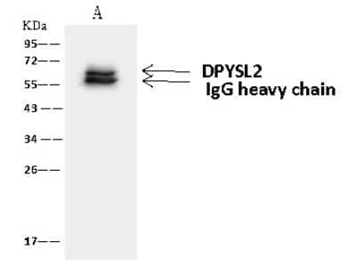 Immunoprecipitation: CRMP2 Antibody [NBP2-97750] - CRMP2 was immunoprecipitated using: Lane A: 0.5 mg Jurkat Whole Cell Lysate 4 ul anti-CRMP2 rabbit polyclonal antibody and 60 ug of Immunomagnetic beads Protein A/G.  Primary antibody: Anti-CRMP2 rabbit polyclonal antibody, at 1:100 dilution. Secondary antibody: Goat Anti-Rabbit IgG (H+L)/HRP at 1/10000 dilution. Developed using the ECL technique. Performed under reducing conditions. Predicted band size: 62 kDa. Observed band size: 62 kDa