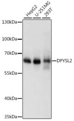 Western Blot: CRMP2 Antibody [NBP2-92939] - Analysis of extracts of various cell lines, using CRMP2 at 1:1000 dilution.Secondary antibody: HRP Goat Anti-Rabbit IgG (H+L) at 1:10000 dilution.Lysates/proteins: 25ug per lane.Blocking buffer: 3% nonfat dry milk in TBST.Detection: ECL Basic Kit .Exposure time: 10s.