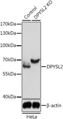 Western Blot: CRMP2 Antibody [NBP2-92939] - Analysis of extracts from normal (control) and DPYSL2 knockout (KO) HeLa cells, using CRMP2 antibody at 1:3000 dilution. Secondary antibody: HRP Goat Anti-Rabbit IgG (H+L) at 1:10000 dilution. Lysates/proteins: 25ug per lane. Blocking buffer: 3% nonfat dry milk TBST. Detection: ECL Basic Kit . Exposure time: 5s