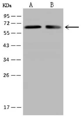 Western Blot: CRMP2 Antibody [NBP2-97750] - Anti-CRMP2 rabbit polyclonal antibody at 1:500 dilution. Lane A: Jurkat Whole Cell Lysate Lane B: U87MG Whole Cell Lysate Lysates/proteins at 30 ug per lane. Secondary Goat Anti-Rabbit IgG (H+L)/HRP at 1/10000 dilution. Developed using the ECL technique. Performed under reducing conditions. Predicted band size: 62 kDa. Observed band size: 62 kDa