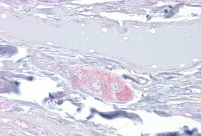 Immunohistochemistry: CRMP4 Antibody [NBP2-87213] - Immunohistochemistry with Small intestine, submucosal plexus tissue. Antibody concentration: 10ug/ml
