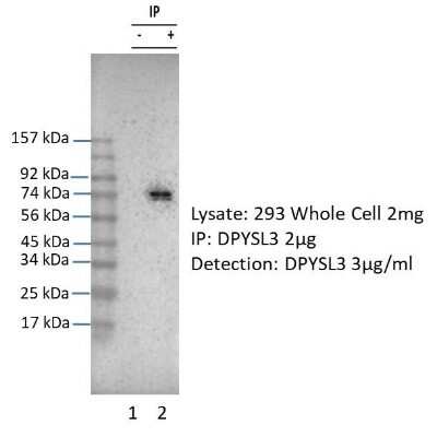 Immunoprecipitation: CRMP4 Antibody [NBP2-87213] - DRYSL3 was immunoprecipitated from 1 mg HEK293 Whole Cell Lysate with NBP2-87213 with 1:200 dilution. Western blot was performed using NBP2-87213 at 1/1000 dilution. Lane 1: Control IP in HEK293 Whole Cell Lysate. Lane 2: DRYSL3 IP with NBP2-87213