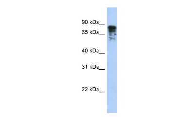Western Blot: CRMP4 Antibody [NBP2-87213] - WB Suggested Anti-DPYSL3 Antibody Titration: 0.2-1 ug/ml. ELISA Titer: 1:1562500. Positive Control: Transfected 293T