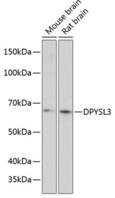 Western Blot: CRMP4 Antibody [NBP2-92073] - Analysis of extracts of various cell lines, using CRMP4 at 1:1000 dilution.Secondary antibody: HRP Goat Anti-Rabbit IgG (H+L) at 1:10000 dilution.Lysates/proteins: 25ug per lane.Blocking buffer: 3% nonfat dry milk in TBST.Detection: ECL Basic Kit .Exposure time: 3min.