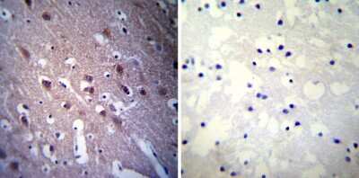 Immunohistochemistry-Paraffin: CRMP5 Antibody (CR-1) [NB100-74395] - Biopsies of deparaffinized Human brain tissue.