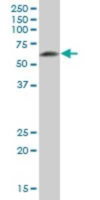 Western Blot: CRMP5 Antibody [H00056896-B01P] - Analysis of DPYSL5 expression in rat brain.