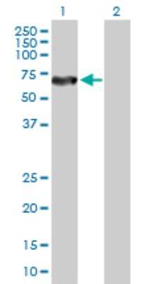 Western Blot: CRMP5 Antibody [H00056896-D01P] - Analysis of DPYSL5 expression in transfected 293T cell line by DPYSL5 polyclonal antibody.Lane 1: DPYSL5 transfected lysate(61.40 KDa).Lane 2: Non-transfected lysate.