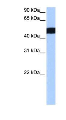 Western Blot: CROCCL2 Antibody [NBP1-79470] - MCF-7 whole cell lysates, concentration 0.2-1 ug/ml.