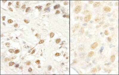 <b>Independent Antibodies Validation. </b>Immunohistochemistry: CROP Antibody [NB100-74625] - Sample: FFPE section of human testicular seminoma (left) and mouse colon carcinoma (right). Antibody: Affinity purified rabbit anti-CROP/Luc7A used at a dilution of 1:1,000 (1ug/ml). Detection: DAB