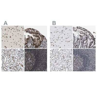 <b>Independent Antibodies Validation. </b>Immunohistochemistry-Paraffin: CROP Antibody [NBP1-88051] - Staining of human cerebral cortex, colon, kidney and lymph node using Anti-LUC7L3 antibody NBP1-88051 (A) shows similar protein distribution across tissues to independent antibody NBP1-88053 (B).