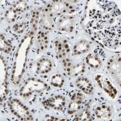 Immunohistochemistry-Paraffin: CROP Antibody [NBP1-88051] - Staining of human kidney shows strong nuclear positivity in cells in tubules.