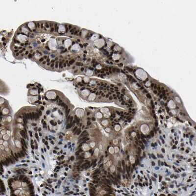 Immunohistochemistry-Paraffin: CROP Antibody [NBP1-88051] - Staining of human colon shows strong nuclear positivity in glandular cells.