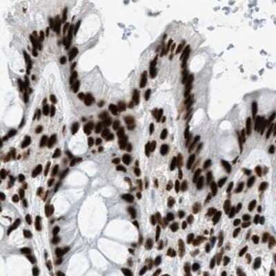 Immunohistochemistry-Paraffin: CROP Antibody [NBP1-88052] - Staining of human colon.