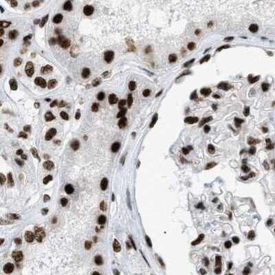 <b>Independent Antibodies Validation. </b>Immunohistochemistry-Paraffin: CROP Antibody [NBP1-88052] - Staining of human kidney.