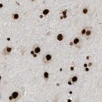 Immunohistochemistry-Paraffin: CROP Antibody [NBP1-88052] - Staining of human cerebral cortex.