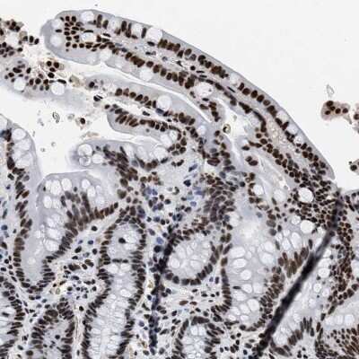 Immunohistochemistry-Paraffin: CROP Antibody [NBP1-88053] - Staining of human colon shows strong nuclear positivity in glandular cells.