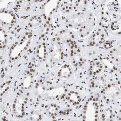 Immunohistochemistry-Paraffin: CROP Antibody [NBP1-88053] - Staining of human kidney shows strong nuclear positivity in cells in tubules.