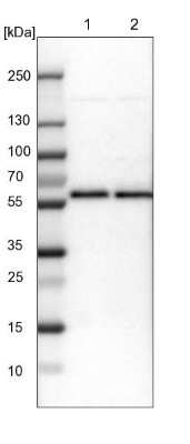 Western Blot: CROP Antibody [NBP1-88052] - Lane 1: NIH-3T3 cell lysate (Mouse embryonic fibroblast cells), Lane 2: NBT-II cell lysate (Rat Wistar bladder tumour cells)