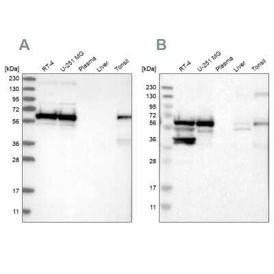 Western Blot: CROP Antibody [NBP1-88052] - Analysis using Anti-LUC7L3 antibody NBP1-88052 (A) shows similar pattern to independent antibody NBP1-88053 (B).