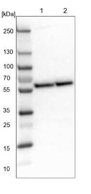 Western Blot: CROP Antibody [NBP1-88053] - Lane 1: NIH-3T3 cell lysate (Mouse embryonic fibroblast cells). Lane 2: NBT-II cell lysate (Rat Wistar bladder tumor cells).