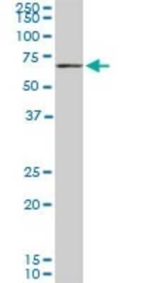 Western Blot: CROT Antibody (1A6) [H00054677-M01] - CROT monoclonal antibody (M01), clone 1A6. Analysis of CROT expression in PC-12.