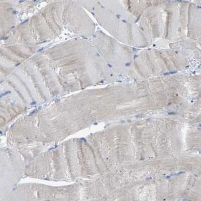 Immunohistochemistry-Paraffin: CROT Antibody [NBP1-85502] - Staining of human skeletal muscle shows low expression as expected.