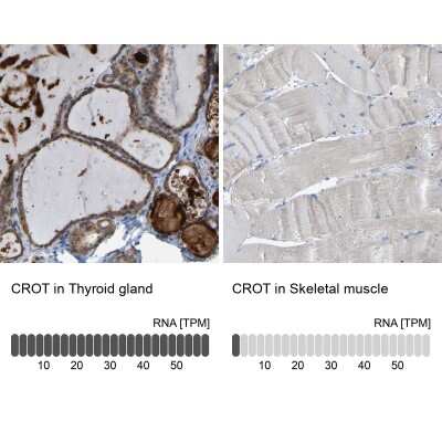 <b>Orthogonal Strategies Validation. </b>Immunohistochemistry-Paraffin: CROT Antibody [NBP1-85502] - Staining in human thyroid gland and skeletal muscle tissues using anti-CROT antibody. Corresponding CROT RNA-seq data are presented for the same tissues.