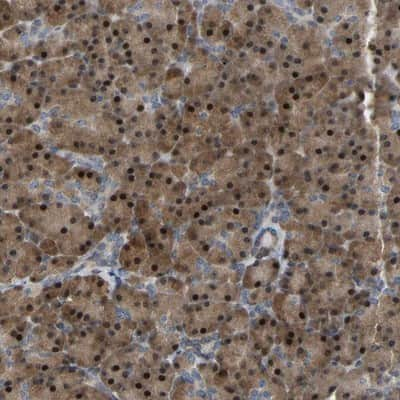 Immunohistochemistry-Paraffin: CROT Antibody [NBP1-85503] - Staining of human pancreas shows strong cytoplasmic and nuclear positivity in exocrine glandular cells.